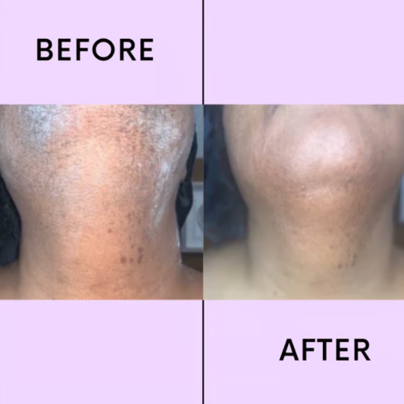 Radianta™ — Reveal Silky Smooth, Hair-Free Skin Without Any Pain or Irritation