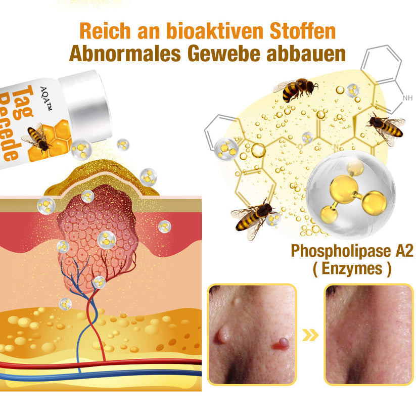 Bee Venom Skin Treatment Spray for Spots and Warts | Suitable for All Skin Types