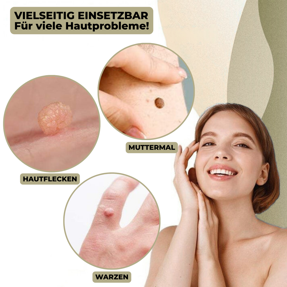 Skin Treatment for Wart and Mole Removal at Home Without Pain