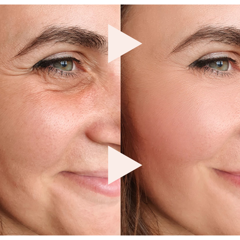 ExpressLift™ — Instantly Reveal Firmer, Radiant Skin That Makes You Feel Unstoppable