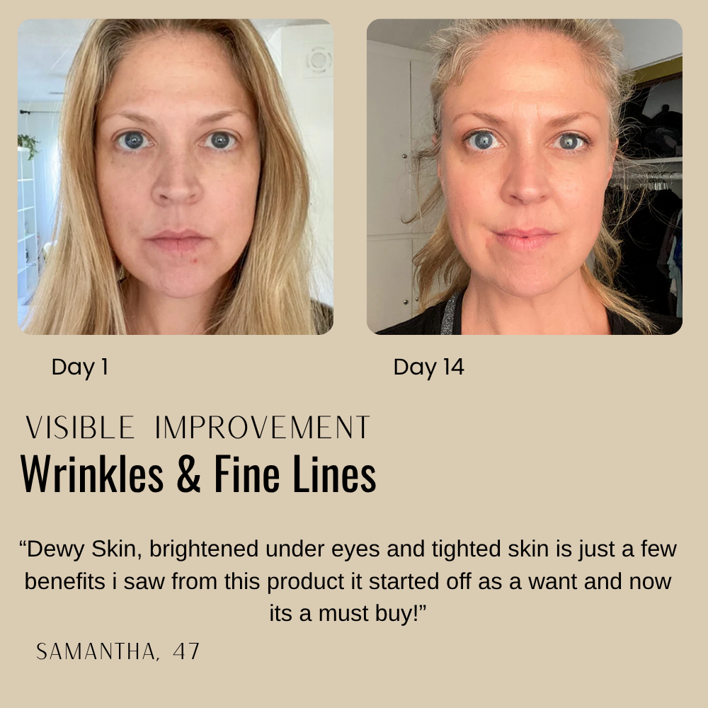Skin Tightening Cream for Youthful, Radiant Complexion Without Injections