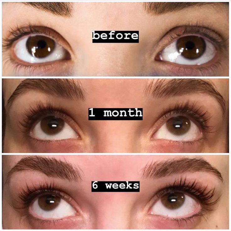 Serum for Enhanced Length and Volume of Eyelashes