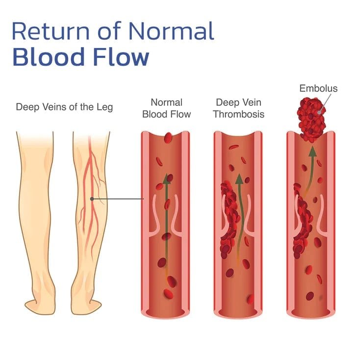 RamoraKnee™ — Melt Away Knee Pain and Step Confidently All Day Long