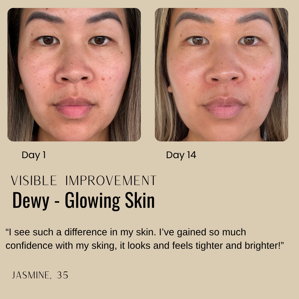Skin Tightening Cream for Youthful, Radiant Complexion Without Injections