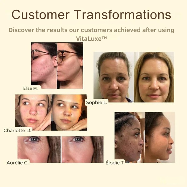 GlowElevate™ — Clear, Radiant Skin That Commands Attention
