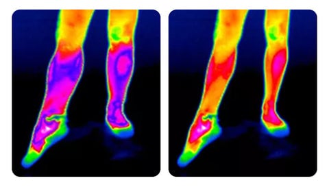 RamoraKnee™ — Melt Away Knee Pain and Step Confidently All Day Long