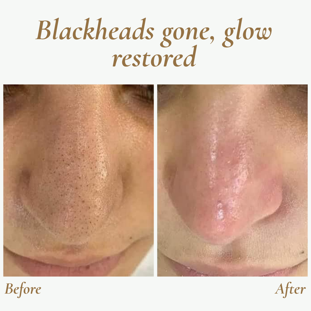 Ultrasonic Skin Cleanser for Professional Use - SkinPulse Device