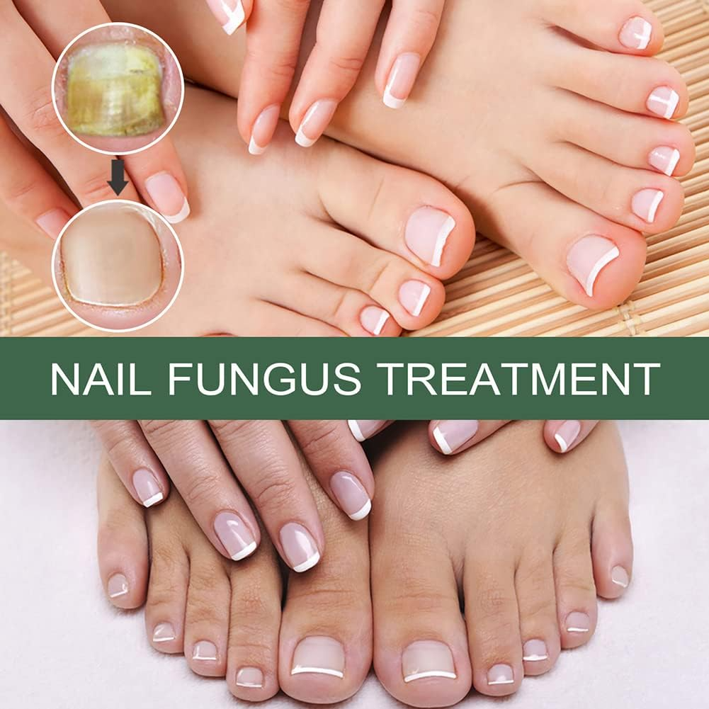 ClearStep™ — Step Confidently with Clear, Strong Nails That Demand Attention