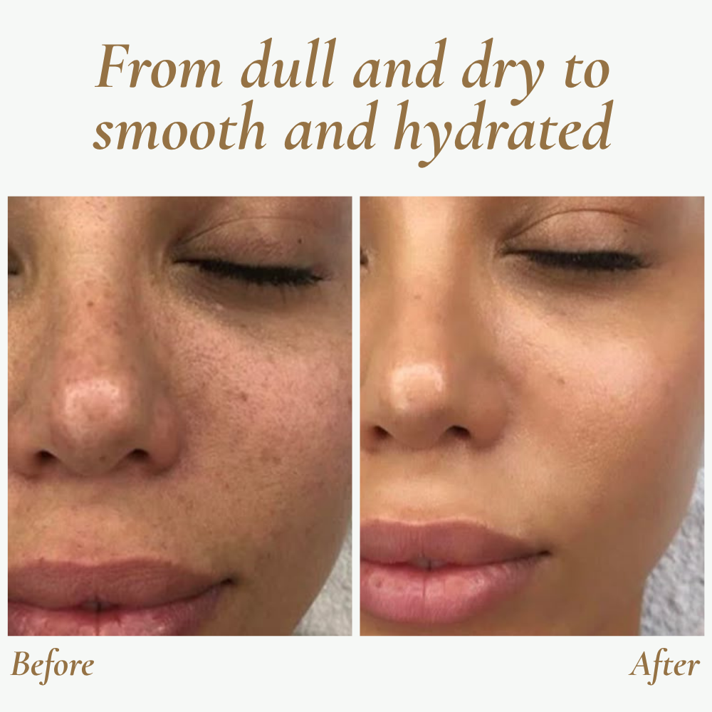 Ultrasonic Skin Cleanser for Professional Use - SkinPulse Device