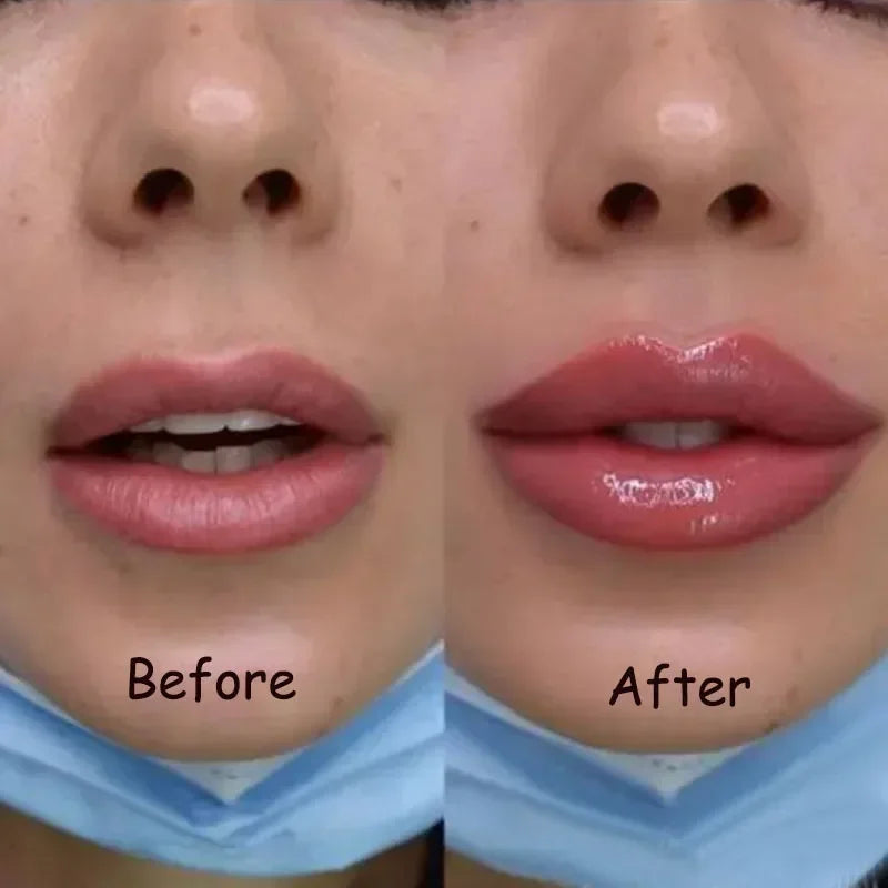 Hydrating Lip Gloss for Volume - Instant Lip Plumper Serum