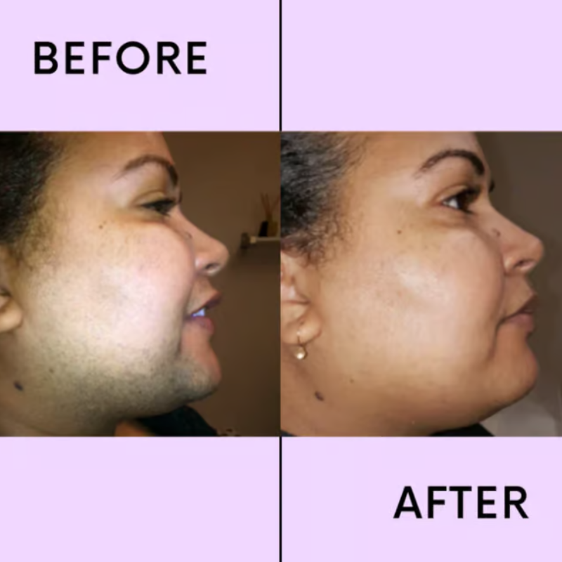 SilkenMist™ — Unlock Radiant, Bump-Free Skin That Boosts Your Confidence Instantly