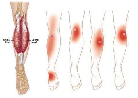 RamoraKnee™ — Melt Away Knee Pain and Step Confidently All Day Long
