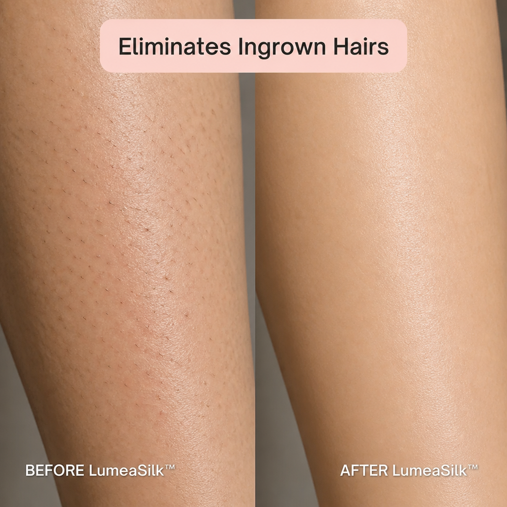 LumeaSilk™ — Trim the Bikini Line Free from Cuts, Burns, or Ingrown Hairs