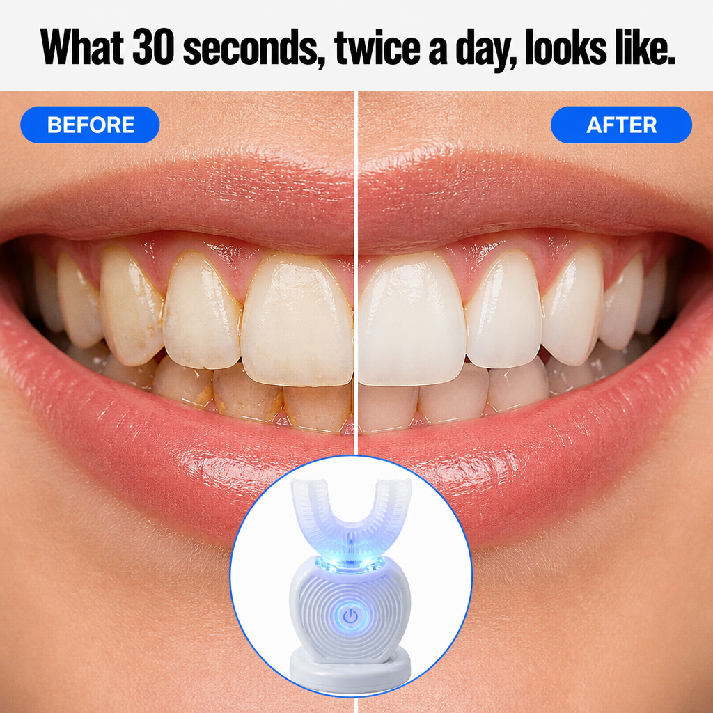 SonicBeam™ Complete — Clean Every Tooth Simultaneously in 30 Hands-Free Seconds