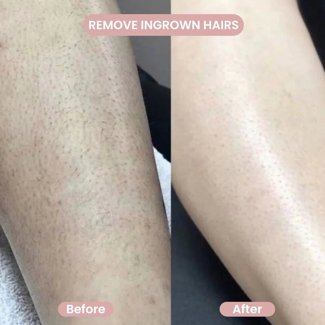 LunaSilk™ — Effortless Glow and Silky Skin Without a Single Cut or Irritation