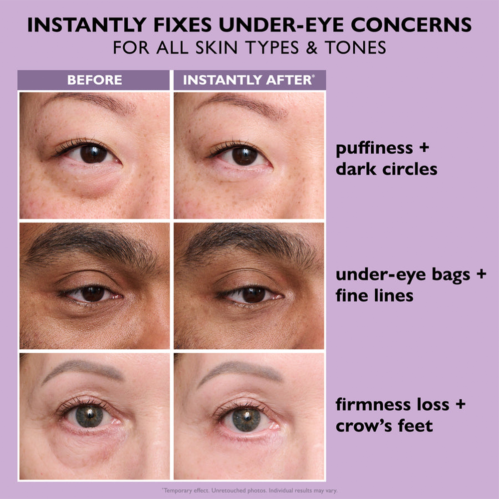 VivaLuxe™ — Wake Up to Youthful, Radiant Eyes Instantly