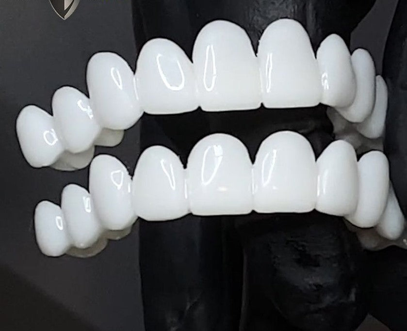 Perfect Smile Snap-On Teeth Cover