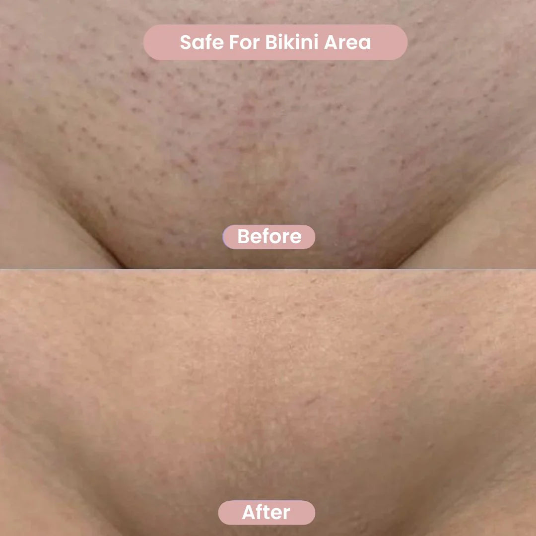 LunaSilk™ — Effortless Glow and Silky Skin Without a Single Cut or Irritation