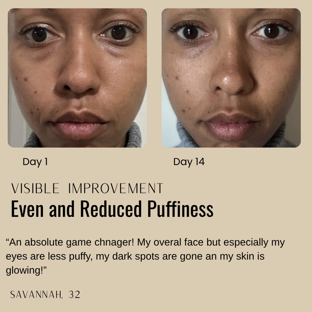 Skin Tightening Cream for Youthful, Radiant Complexion Without Injections