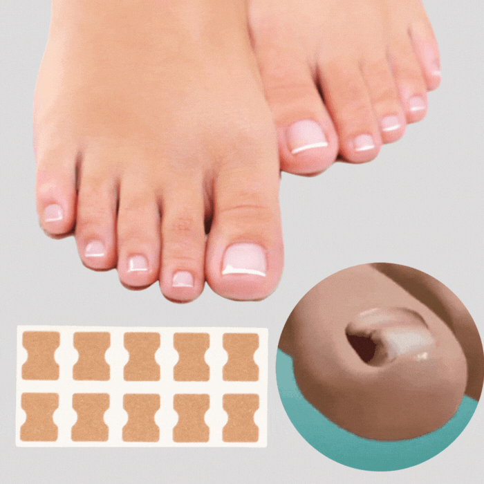OrthoNailPro™ — Effortless Relief & Confident Feet Without Pain or Shame