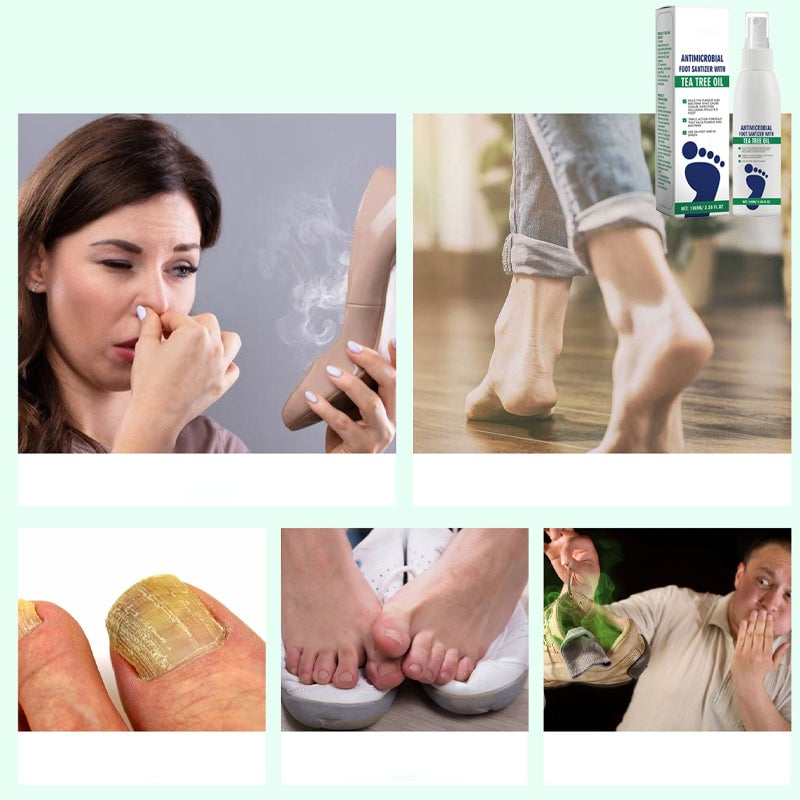 Tea Tree Oil Foot Spray with Antimicrobial Properties