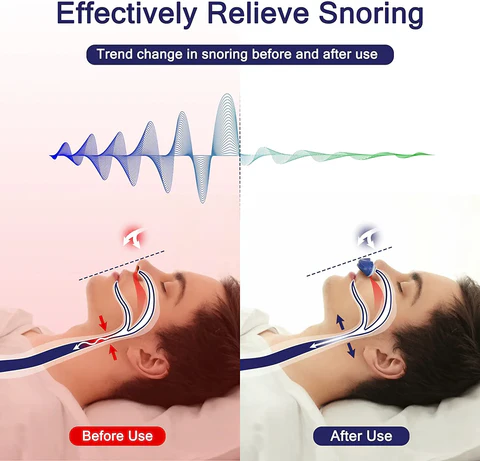 Travel Sleep Apnea Device - Compact CPAP Alternative for Snoring Relief