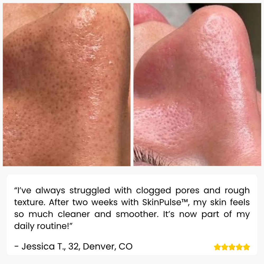 Ultrasonic Skin Cleanser for Professional Use - SkinPulse Device