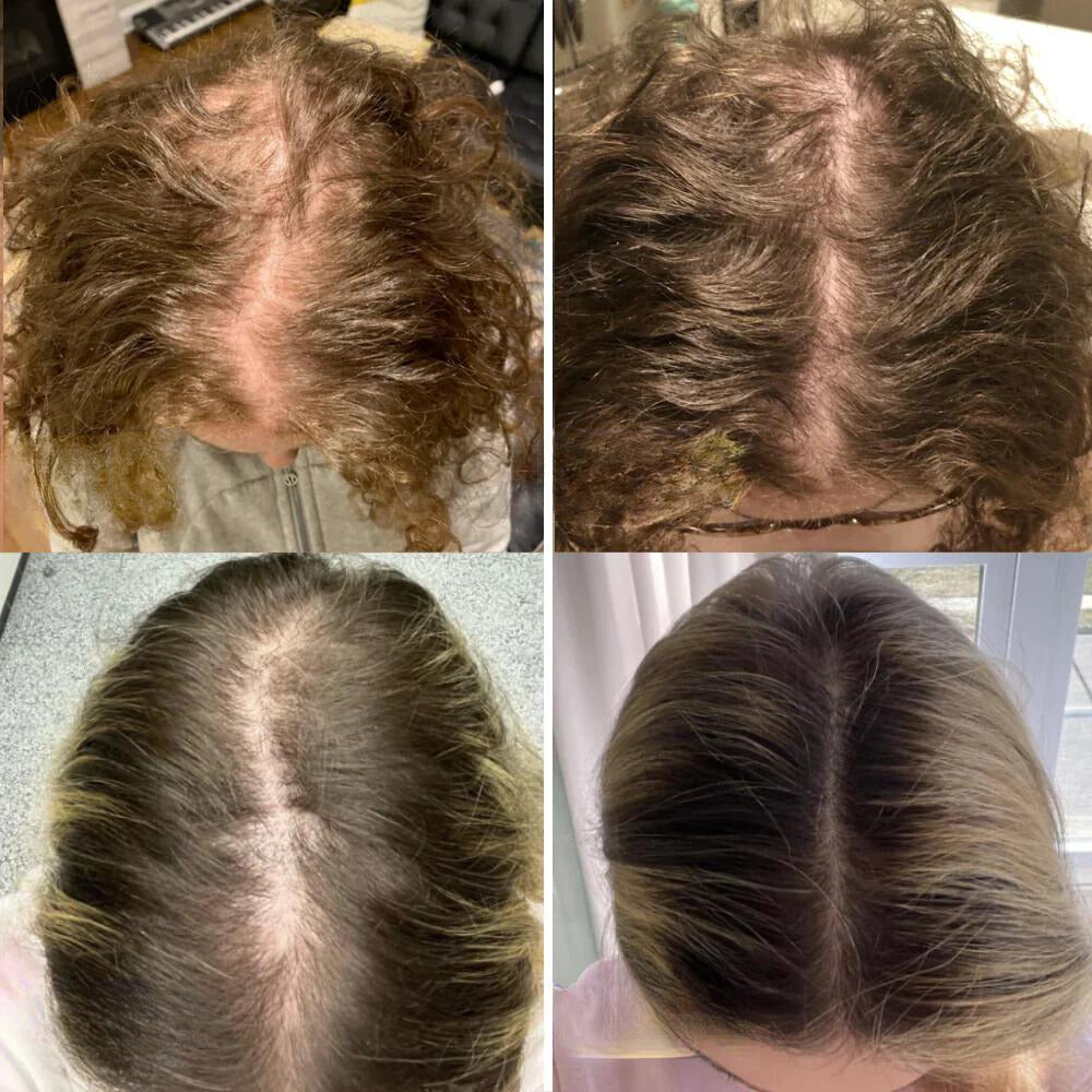 RevitaSilk™ — Unlock Lush, Thick Hair That Commands Attention and Confidence