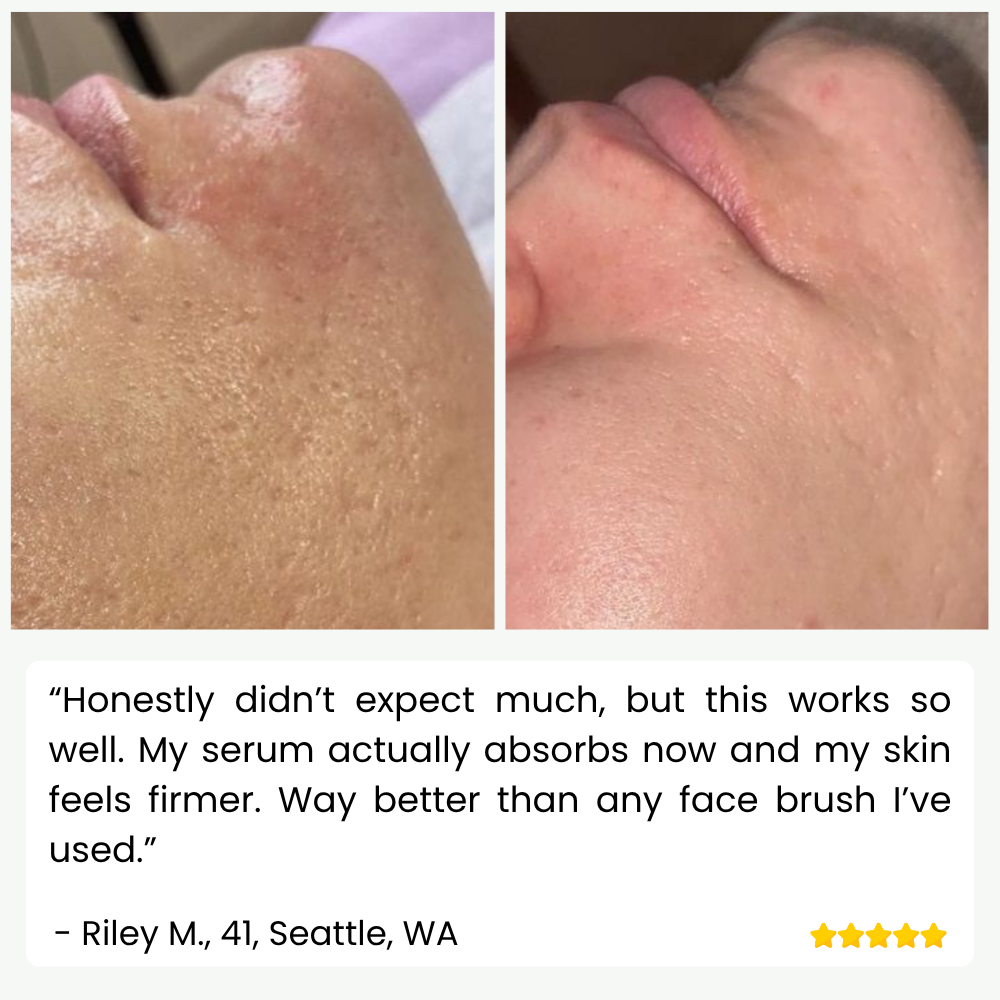 Ultrasonic Skin Cleanser for Professional Use - SkinPulse Device
