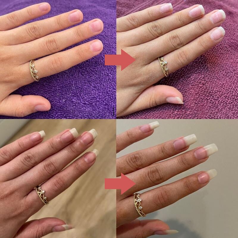 Nail Growth Oil with Nutrients for Healthy Nails