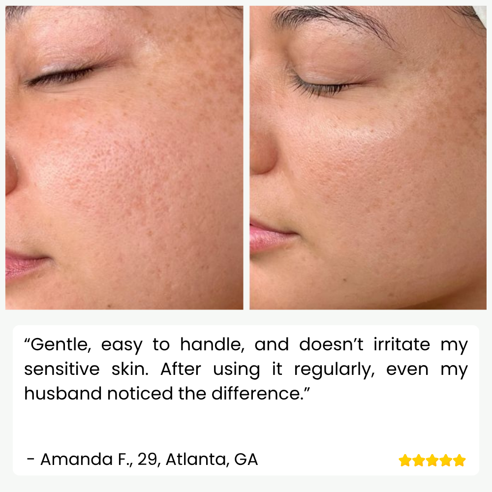 Ultrasonic Skin Cleanser for Professional Use - SkinPulse Device