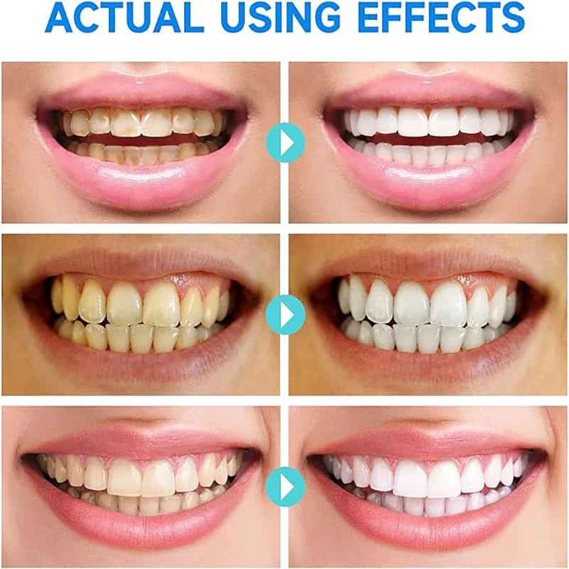 LumaWhite™ — Unlock a Radiant Smile That Boosts Your Confidence Instantly