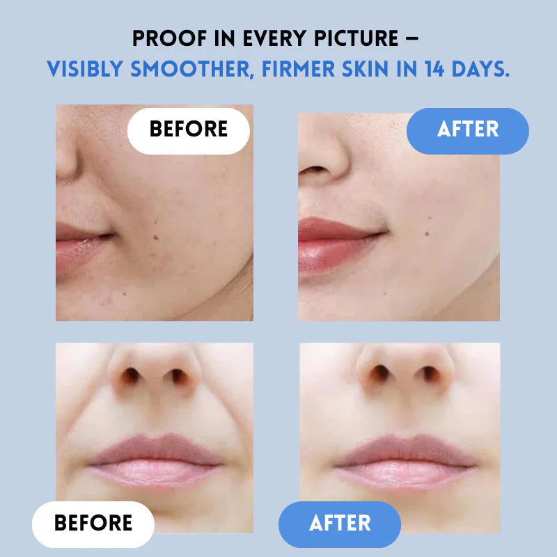 VelaLift™ — Instantly Reveal Youthful, Radiant Skin That Turns Heads