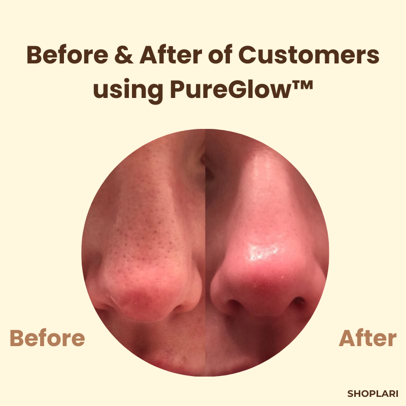 RadiantAura™ Black Tea Mask — Unleash a Youthful Glow That Makes You Shine from Within