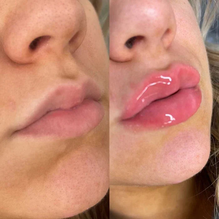Hydrating Lip Gloss for Volume - Instant Lip Plumper Serum