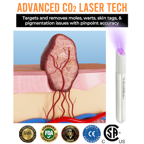 CO₂ Technology Laser Pen for Treating Skin Imperfections