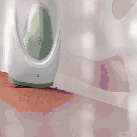 Hair Removal Device | IPL System for Home Use | Gentle Hair Reduction