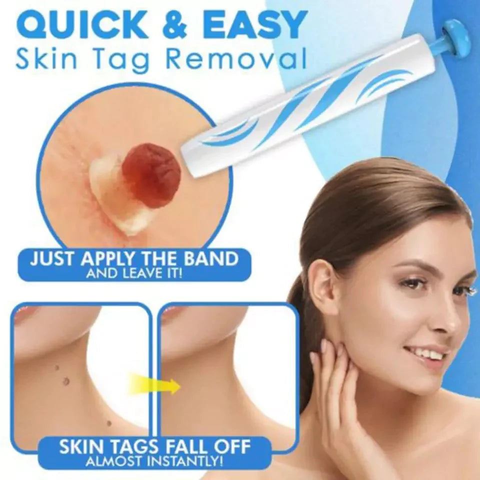 Skin Tag Removal Kit for Home Use | Targeted Painless Tool