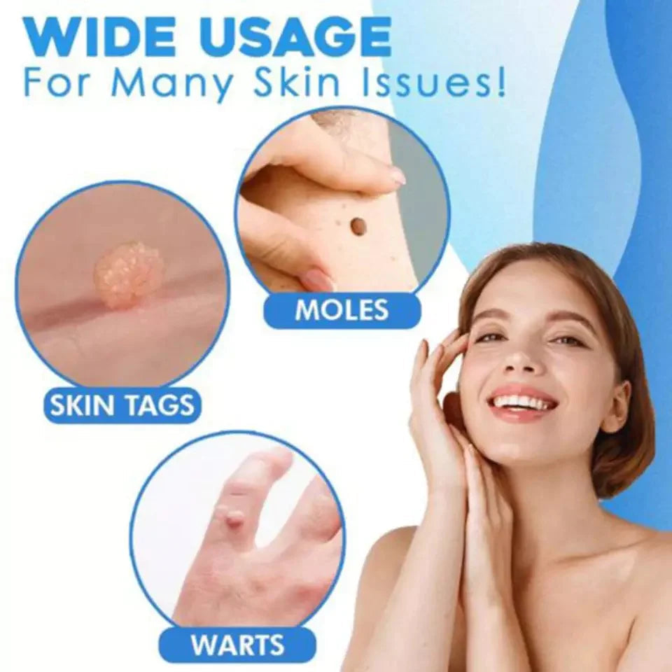 Skin Tag Removal Kit for Home Use | Targeted Painless Tool