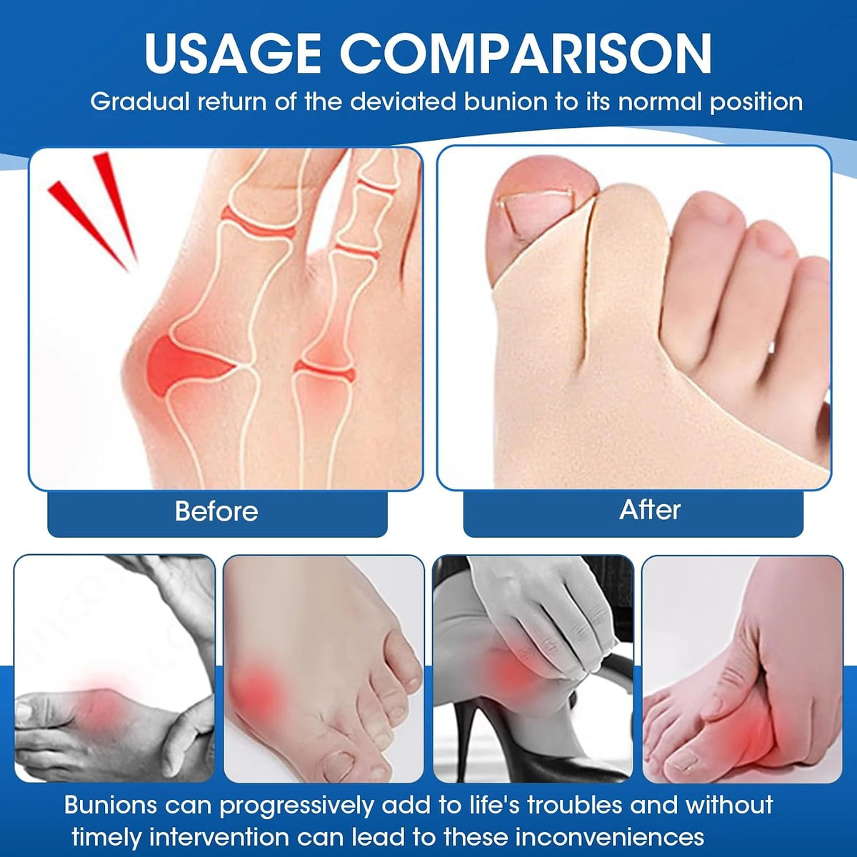 Big Toe Corrector Low-Profile Stretch Fit Washable