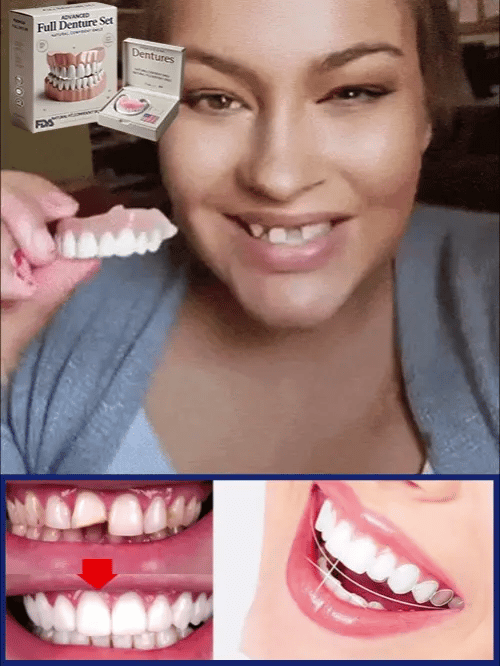 Denture Kit Warm-Water Moldable Upper & Lower Set