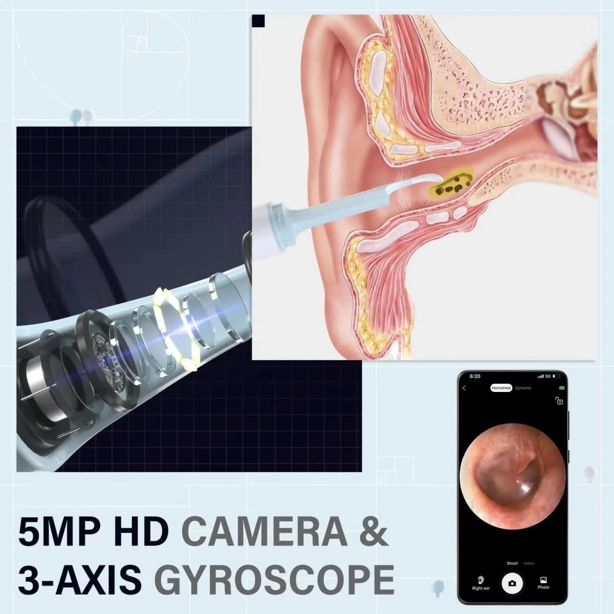 Ear Inspection Camera HD Imaging 6 LED Lights