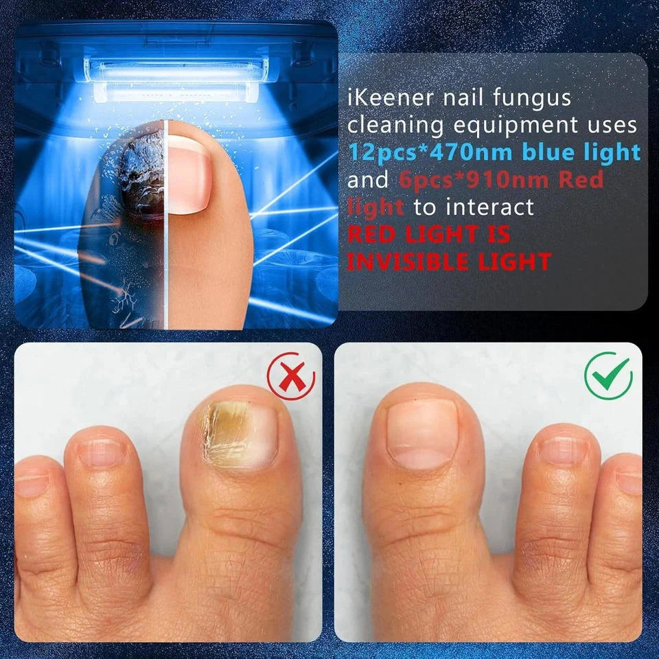 Nail Therapy Device Dual-Wavelength Light Automatic Sensor