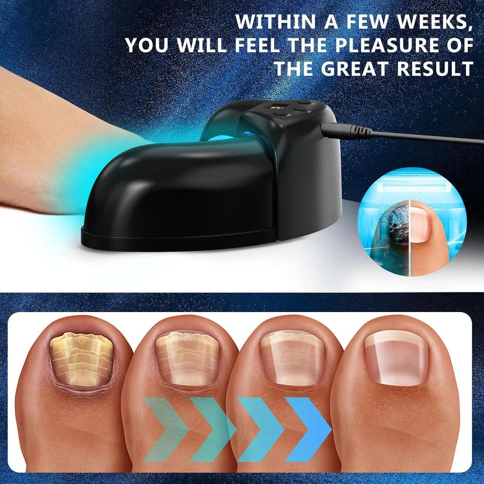 Nail Therapy Device Dual-Wavelength Light Automatic Sensor