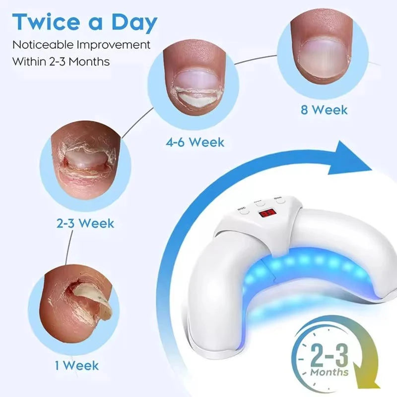 Nail Therapy Device Dual-Wavelength Light Automatic Sensor