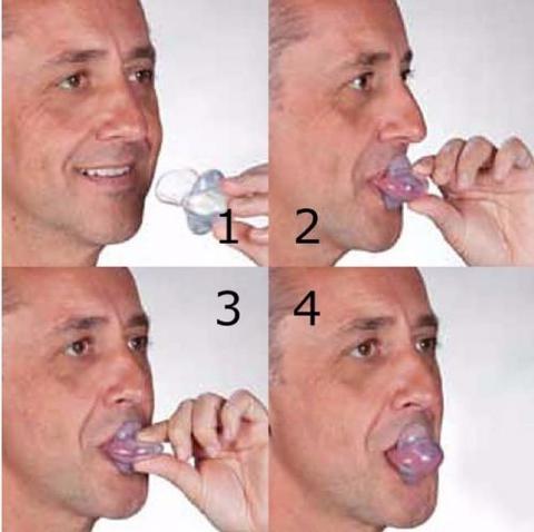 Tongue Stabilizing Device Medical-Grade Silicone One Size Denture-Friendly