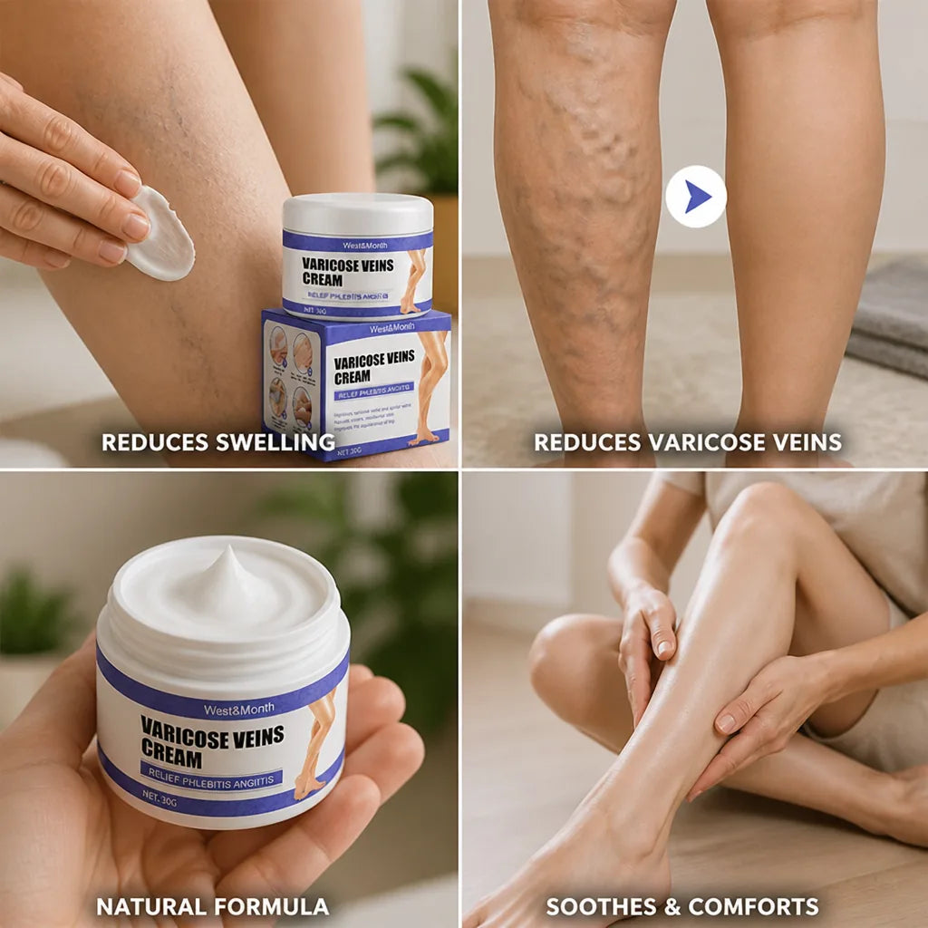 Varicose Vein Cream Herbal & Cooling Reduces Swelling