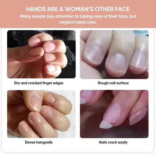 Nail Treatment Oil for Stronger Nails and Enhanced Confidence