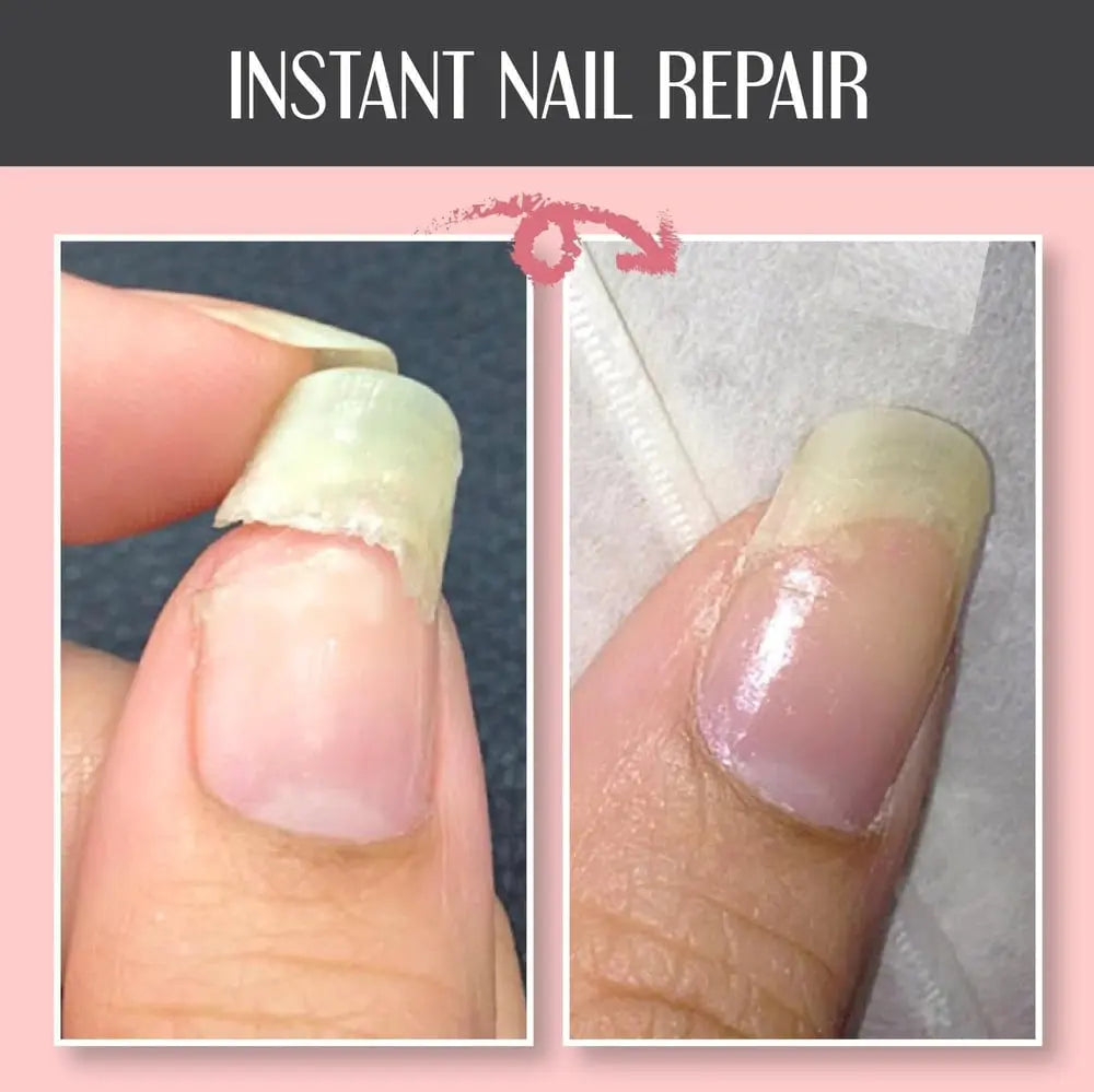 Protective Nail Strengthening Gel – Repair Care for Healthy Nails