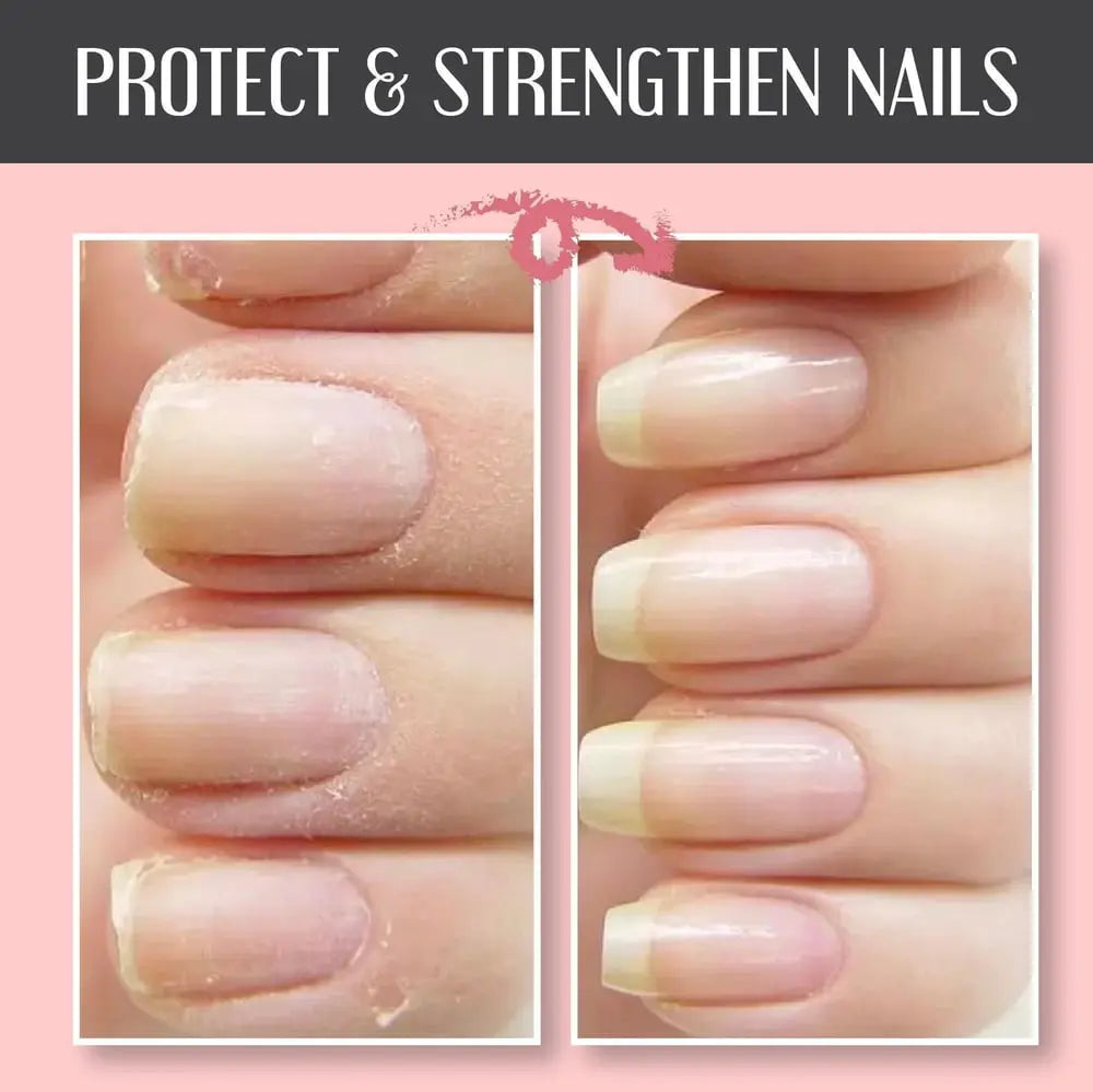 Protective Nail Strengthening Gel – Repair Care for Healthy Nails